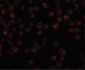 NDUFAF2 / NDUFA12L Antibody (C-Terminus)